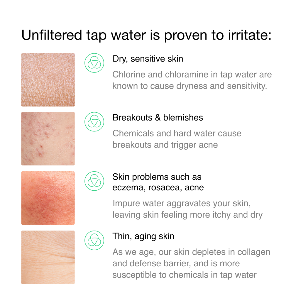 Filterbaby Skincare Faucet Filter 2.0